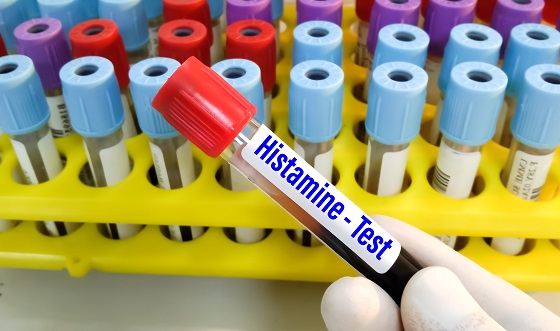 Intoleranta la histamina – cauze, diagnostic si optiuni de tratament