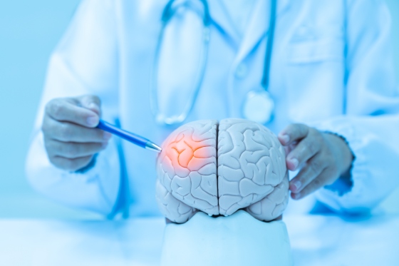 Atrofie cerebrala – cauze, simptome, diagnostic, tratament, complicatii