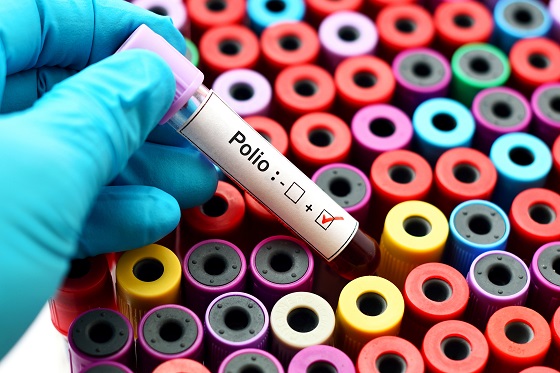 Poliomielita – cauze, diagnostic si tratament