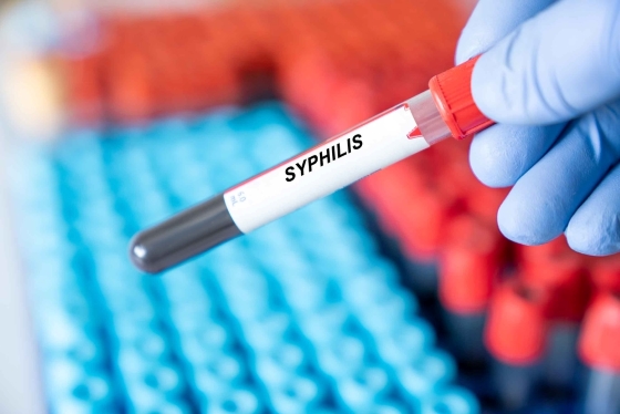 Sifilis: manifestari, transmitere, complicatii, tratament