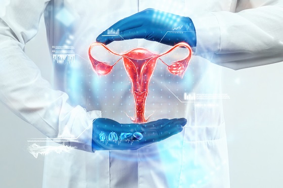 Drilling ovarian: ce este si cum ajuta femeile cu ovare polichistice