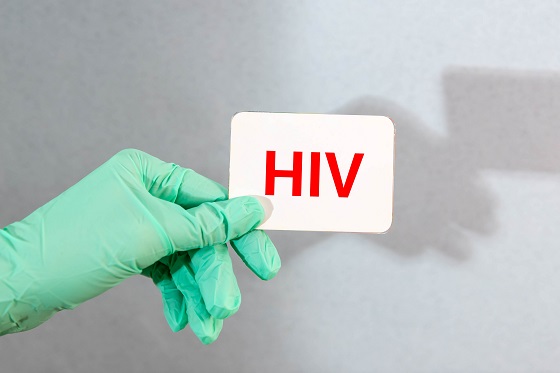 Infectia cu HIV: cauze, cai de transmitere, simptome si tratament modern