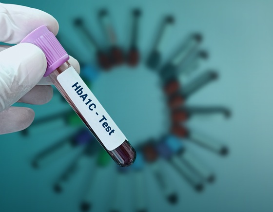 Ce este hemoglobina glicata (HbA1c) si de ce este mai importanta decat glicemia simpla?
