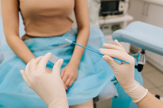 Test Papanicolau: ce inseamna „celule endocervicale prezente”?