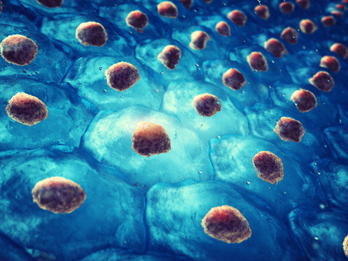 Sindromul Lyell: cauze, simptome, diagnostic si tratament