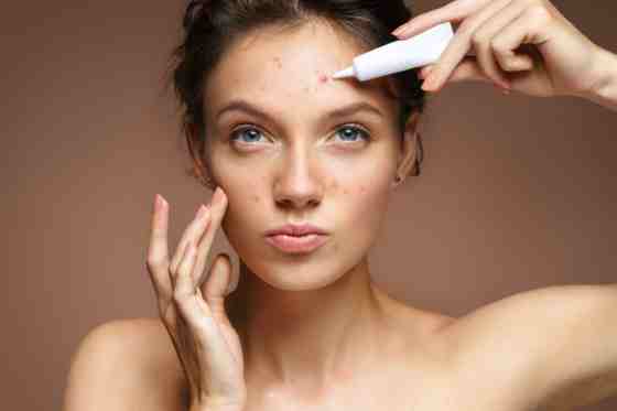 Sfaturi pentru ingrijirea corecta a tenului acneic