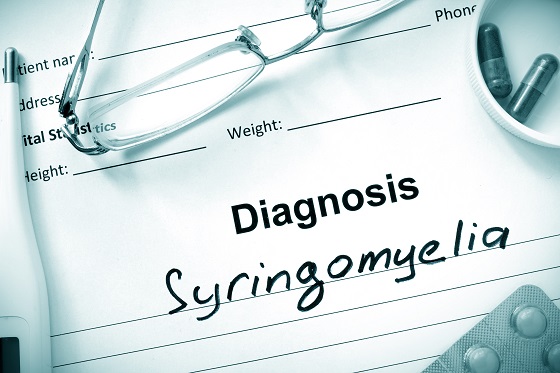 Siringomielia: caracteristici si simptome, complicatii, abordare multidisciplinara