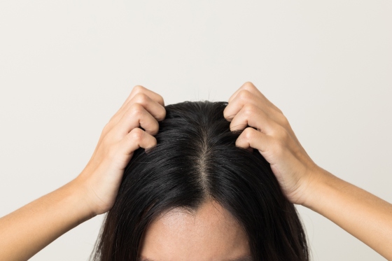 Piritionat de zinc pentru scalp: ce este si cum va ajuta?