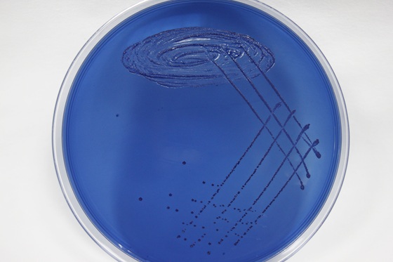 Streptococcus salivarius: ce reprezinta, ce rol joaca, mecanisme de actiune