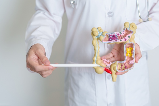 Sigmoidita: ce este, cauze si simptome principale ale inflamatiei colonului sigmoid