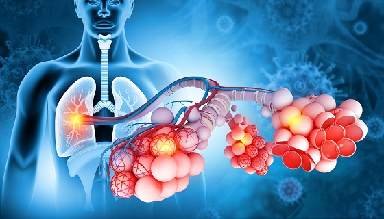 Alveolele pulmonare - rol, functii, patologii asociate