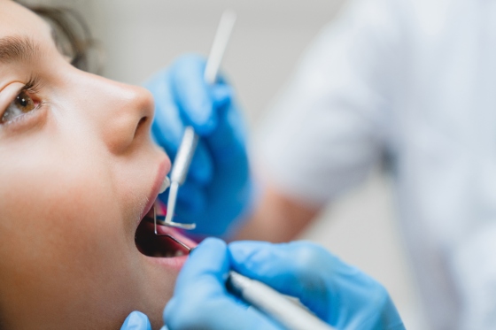Micrognatie: ce este, pasi pentru diagnostic, plan de tratament, impact asupra calitatii vietii