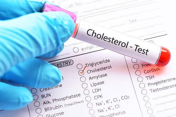 Colesterol seric total – interpretare analiza, valori normale