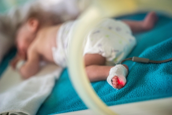 Despre cefalhematom: cauze, simptome, diagnostic si tratament