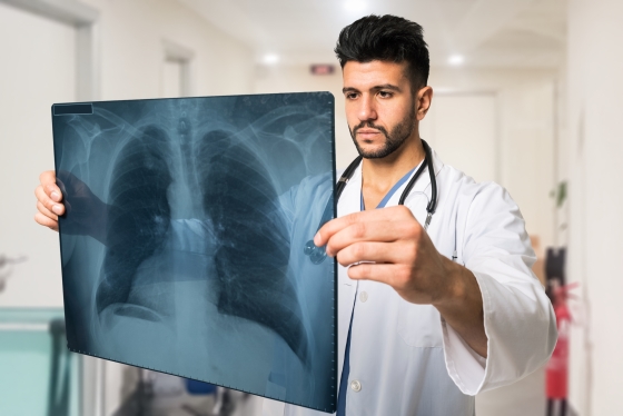 Emfizem pulmonar: cauze, simptome, diagnostic si tratament