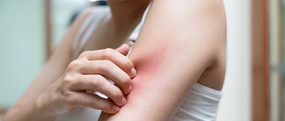 De ce ne mănâncă pielea: ce indica si ce solutii exista