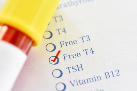 Free T4 sau FT4 (Tiroxina libera) – indicatii si interpretari