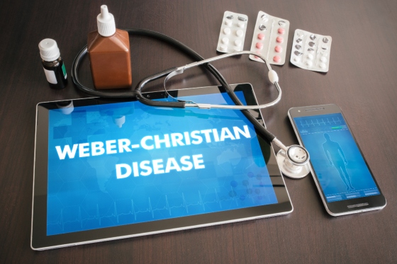 Boala Weber-Christian 
