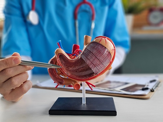 Ulcer gastric – simptome, cauze, diagnostic și tratament