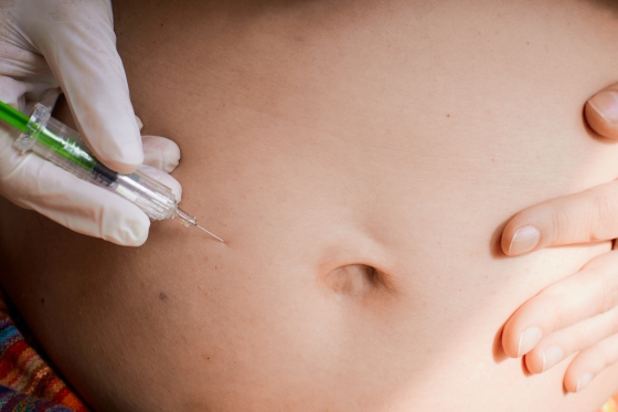 Trombofilie in sarcina – riscuri si tratament