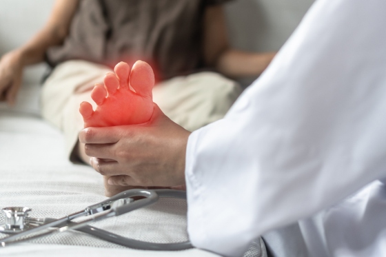 Neuropatie periferica: cum sa recunoasteti semnele si cum sa gestionati boala