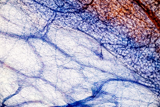 Tesut conjunctiv: anatomie, rol, functii si afectiuni asociate