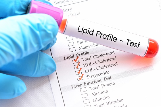 Profil lipidic: realizare, beneficii, indicatii