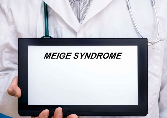 Sindromul Meigs: cauze, simptome, diagnostic si tratament