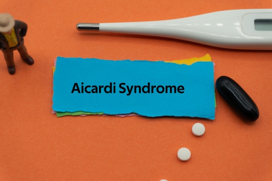 Sindromul Aicardi: cauze, simptome, diagnostic, tratament si complicatii asociate