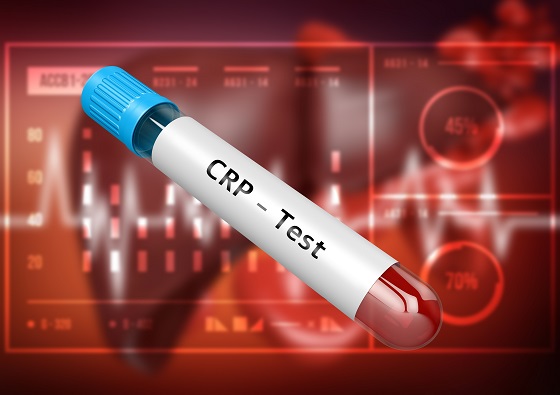 Informatii despre proteina C reactiva (CRP) marita la copii