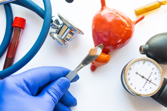 Uretroplastia sau operatia de reconstructie a uretrei