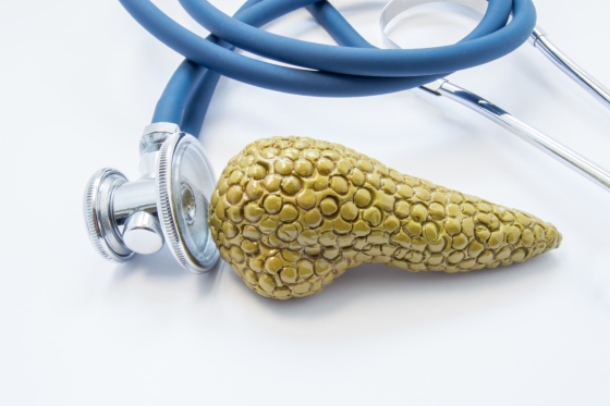 Adenocarcinom: ce este, cauze, factori de risc, diagnostic si tratament