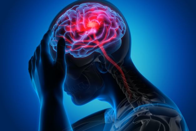 Accident Vascular Cerebral (AVC): Tot ce trebuie sa stii