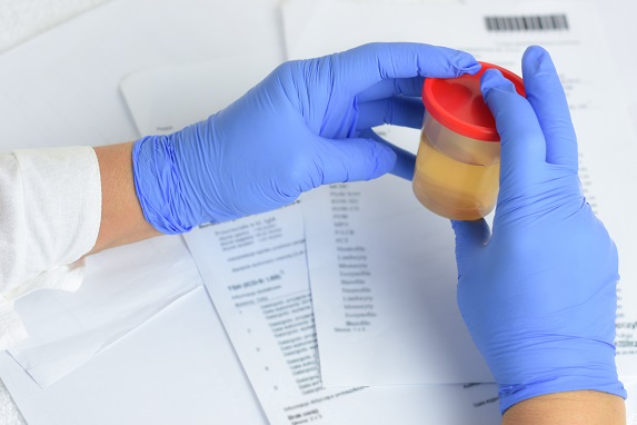 Examenul complet de urina – cum se recolteaza si ce probleme de sanatate poate indica
