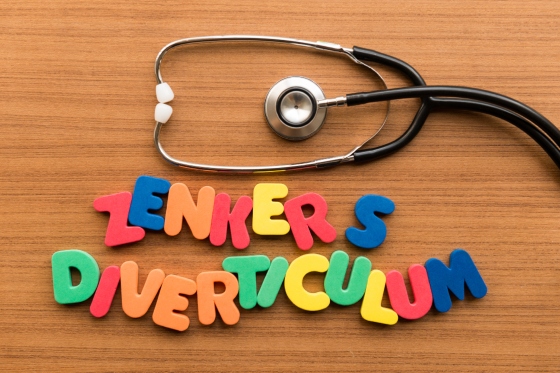 Diverticul Zenker: simptome, diagnostic si tratament