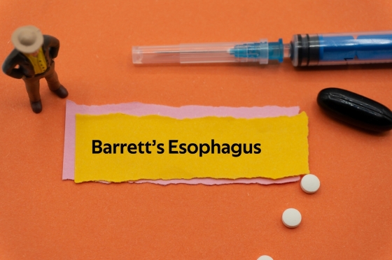 Esofag Barrett – informatii, simptome, cauze, complicatii