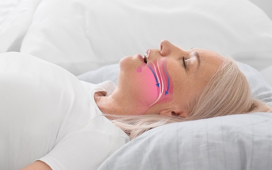 Apneea in somn netratata poate dubla riscul de Parkinson