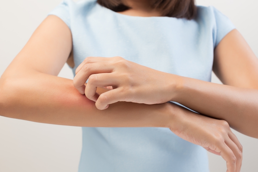 Dermatita atopica la adulti: cauze, manifestari si remedii 