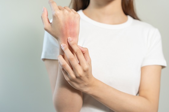 Ingrijirea pielii cu dermatita atopica: sfaturi pentru reducere a iritatiei si mancarimii