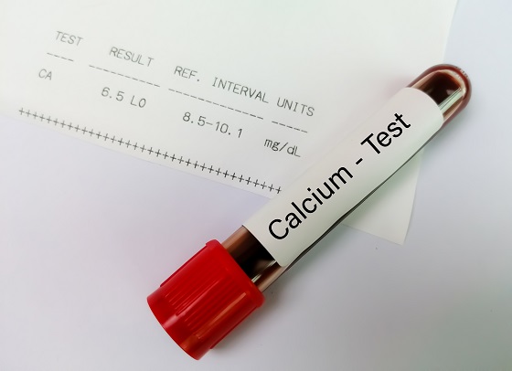 Legatura dintre lipsa de calciu si episoadele de transpiratie abundenta