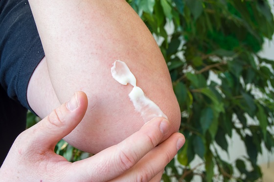Corticosteroizi topici - actiune terapeutica, reguli de administrare