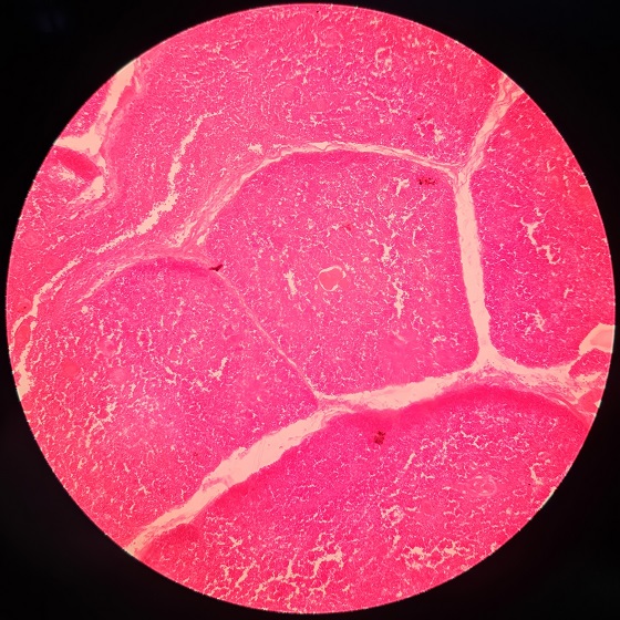 Substanta reticulata: anatomie, functii si rol