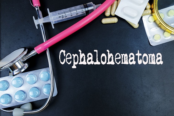 Cefalhematom: cauze, simptome, diagnostic si tratament