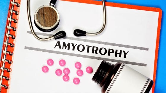 Amiotrofie spinala – factori de risc, cauze, diagnostic si tratament