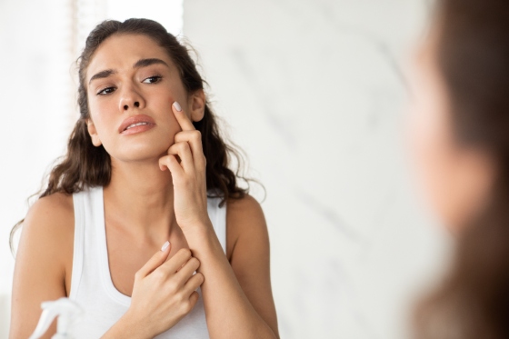 Tratamente actuale pentru acnee: ce functioneaza si ce nu
