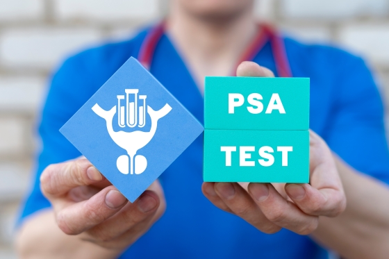 PSA (Antigen specific prostatic): ce este si cand se recomanda