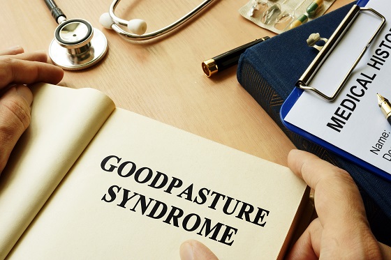 Sindrom Goodpasture: ce este, cauze, simptome, diagnostic si solutii