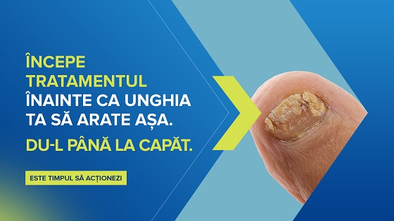 (P) Diabetul si onicomicoza: factori de risc, preventie si tratament