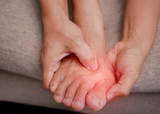 Monturi (hallux valgus): ce sunt, ce cauze au, simptome si tratament