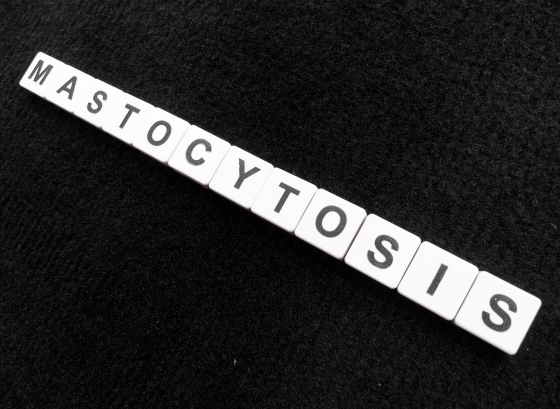 Mastocitoza: cauze, clasificare, simptome, diagnostic si tratament